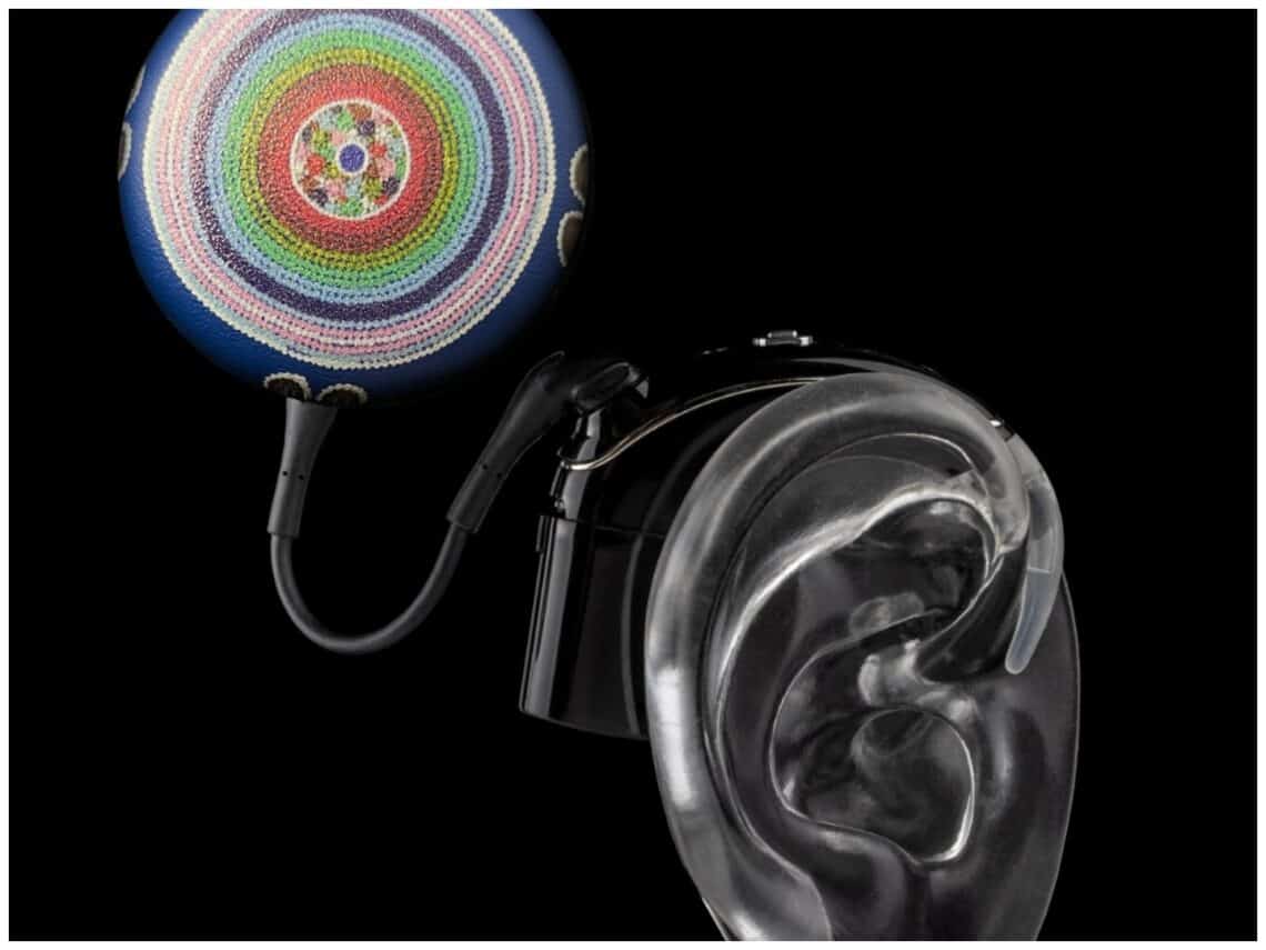 Making a statement; jewellery for cochlear implants and hearing aids ...