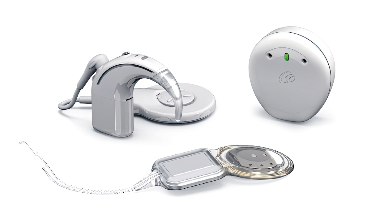 The Future proofed Cochlear Implant Hearing Practitioner Australia