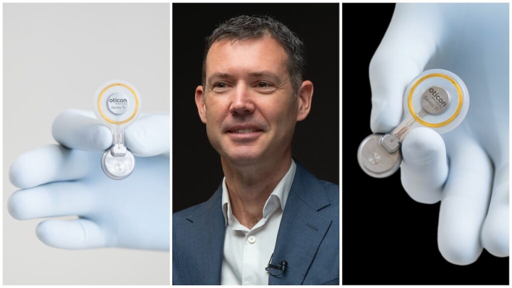 ENT on AIR to host first live stream procedures including Sentio System ...